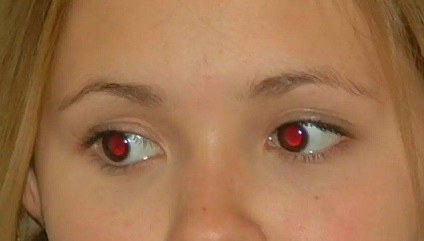 Photoshop Red Eye Tool Tutorial